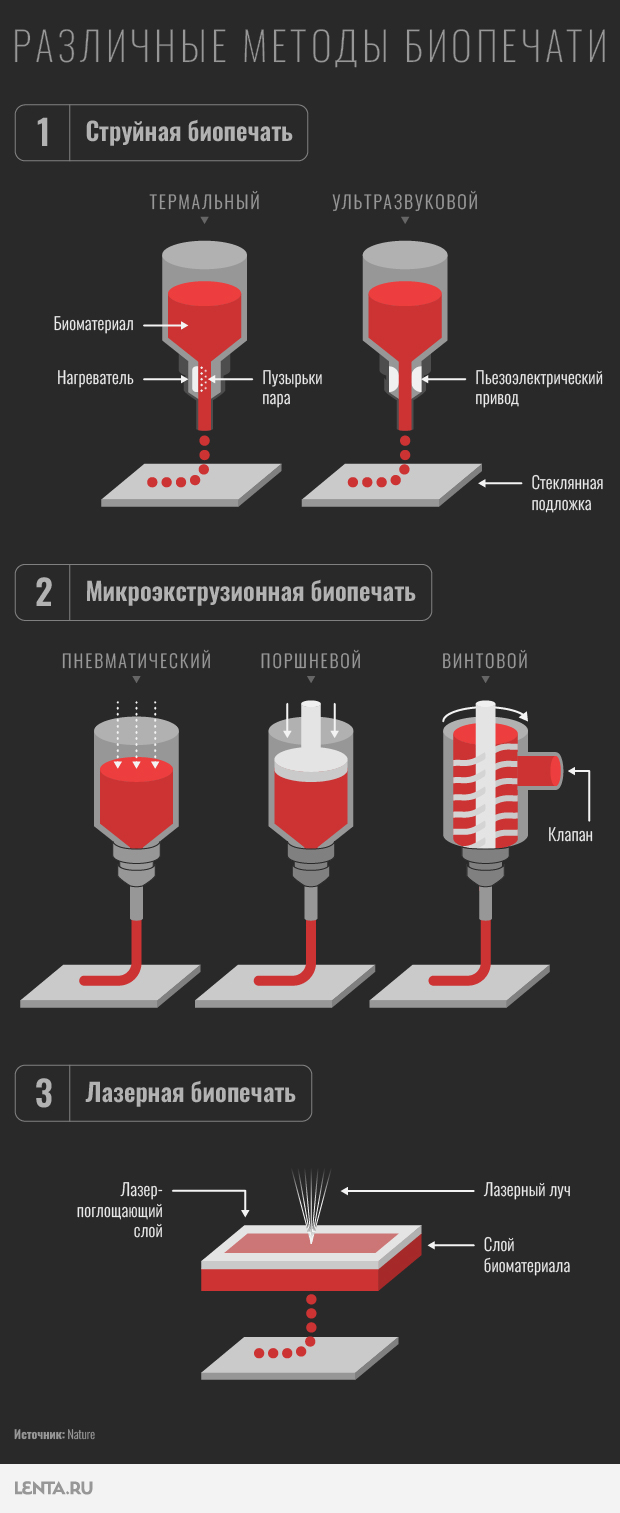 Ученые научились печатать органы на принтере. Почему эта технология спасет  сотни тысяч людей по всему миру?: Здоровье: Наука и техника: Lenta.ru