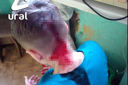 Российский ребенок час пролежал на улице без сознания с пробитой головой