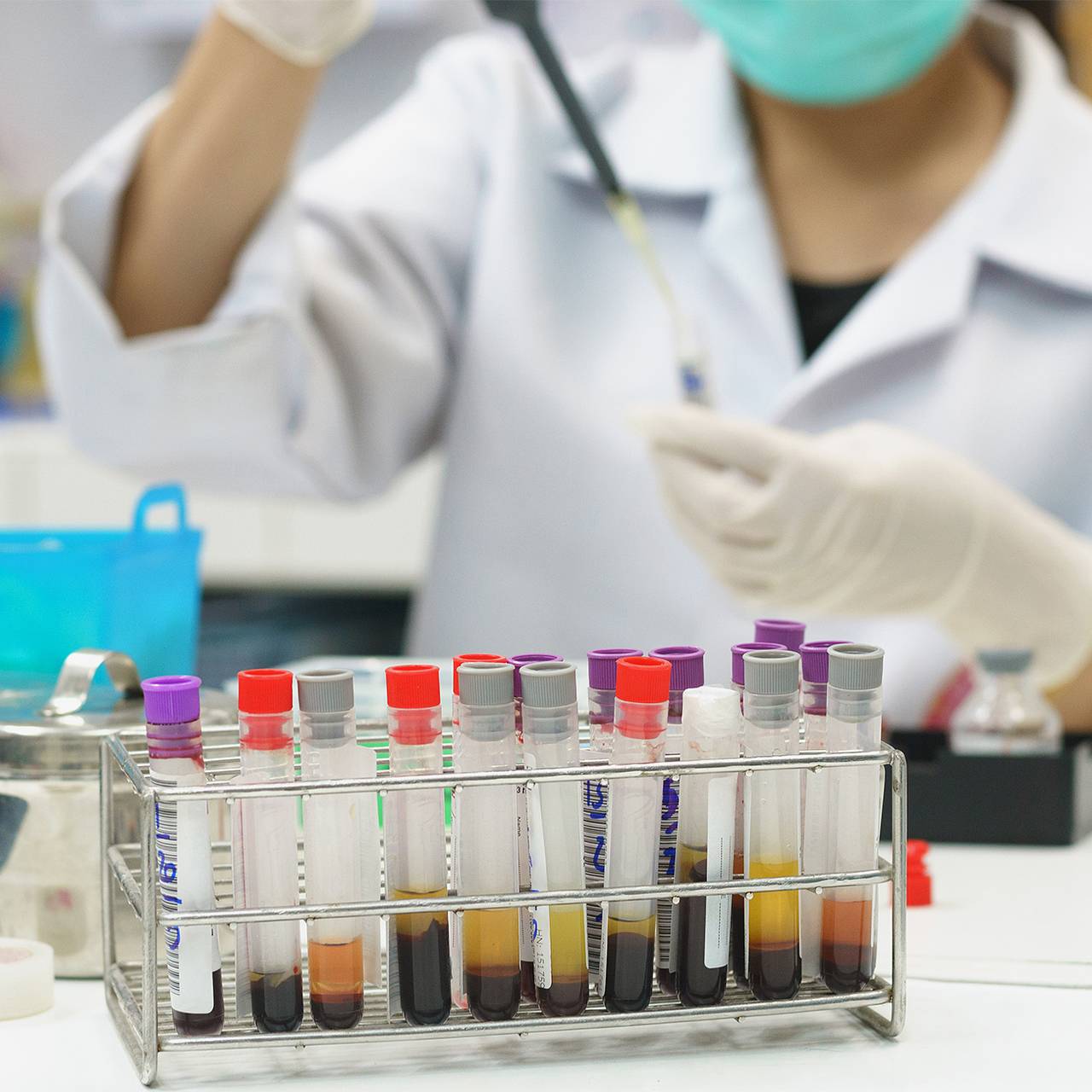 кто открыл вирус вич. ученый вич. история исследования спида. ошибки ученых в науке. Chemical drop.