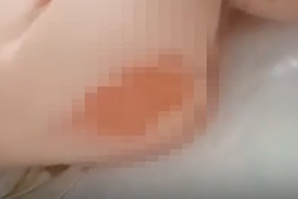 В российском роддоме младенца обожгли кипятком во время купания