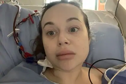 Женщина уснула в неудобной позе и едва не лишилась ног