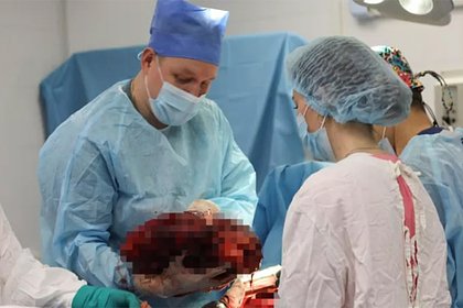 В России врачи удалили упавшему на стройке иностранцу огромную опухоль