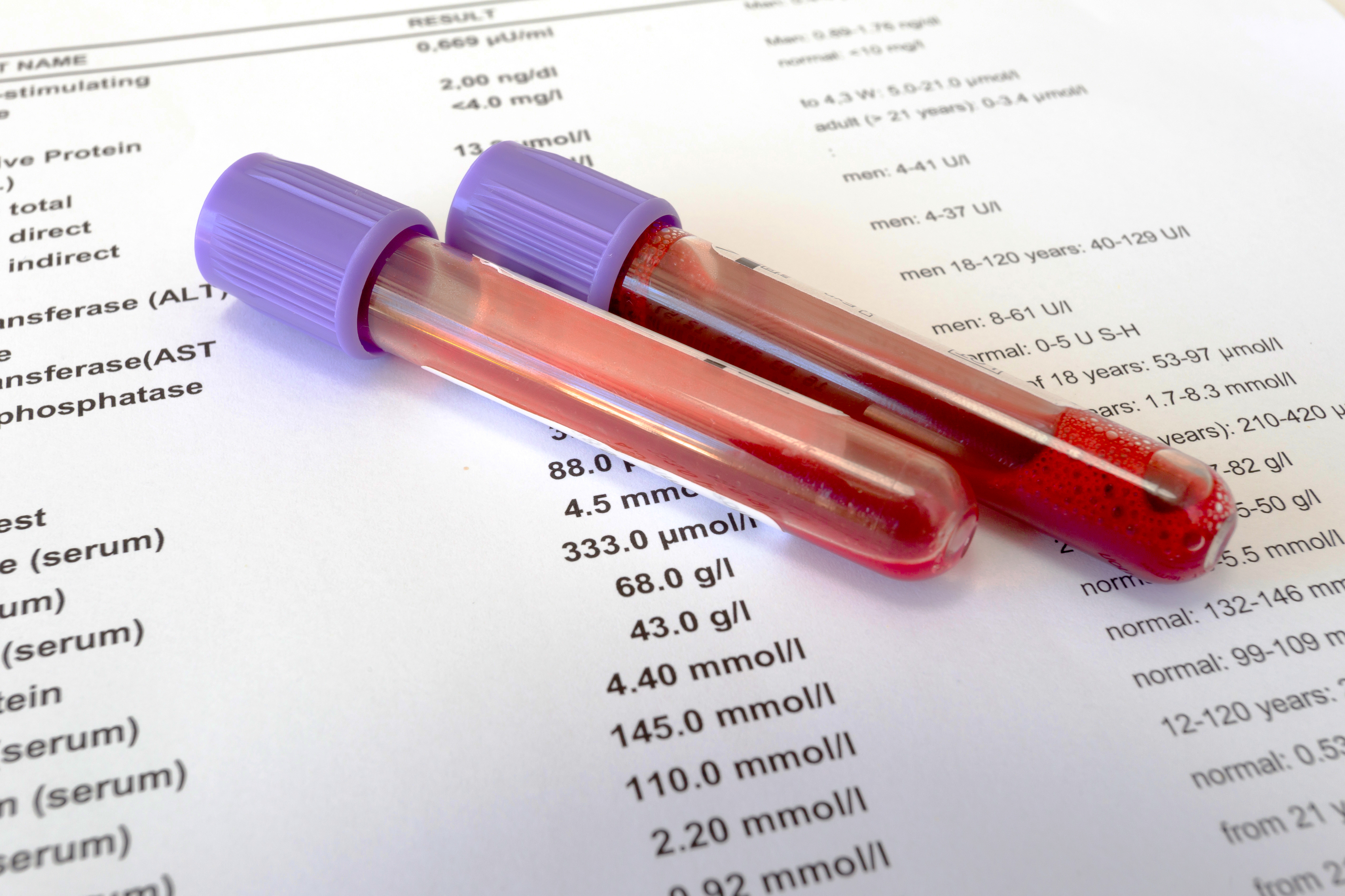 Общий анализ крови: как расшифровать?