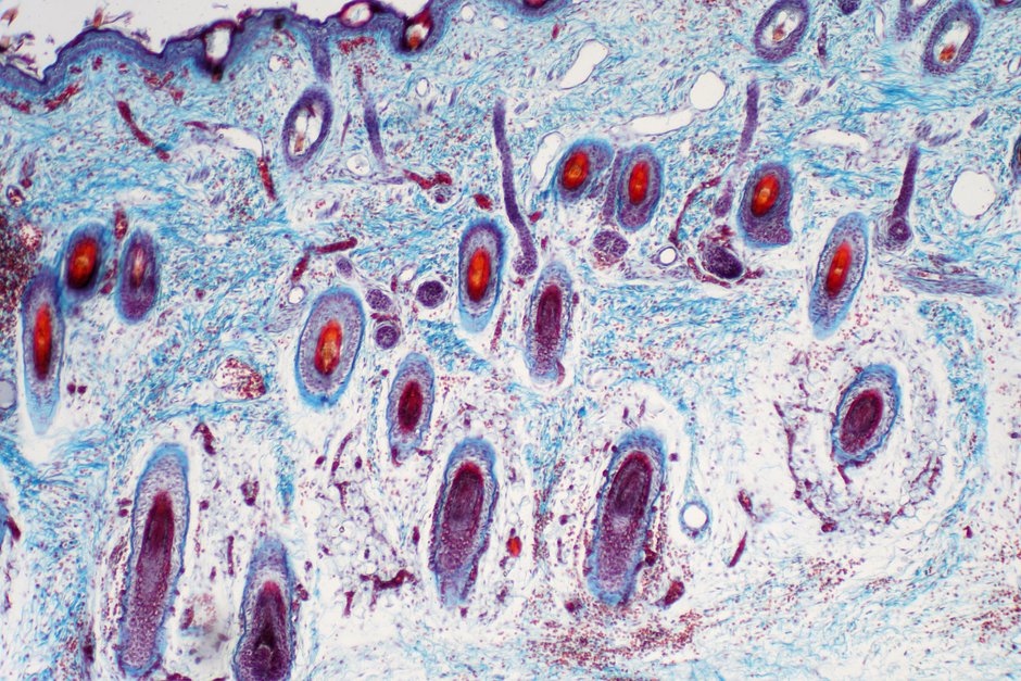 Ткань поперечного сечения кожи человека под микроскопом
