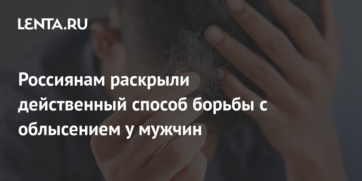 Россиянам раскрыли действенный способ борьбы с облысением у мужчин ...