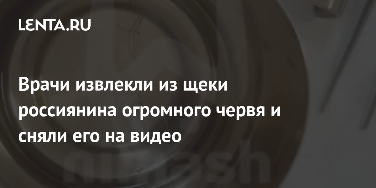 Врачи извлекли из щеки россиянина огромного червя и сняли его на видео: Общество