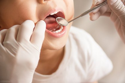 В Петербурге четырехлетний ребенок проглотил зеркало на приеме у стоматолога