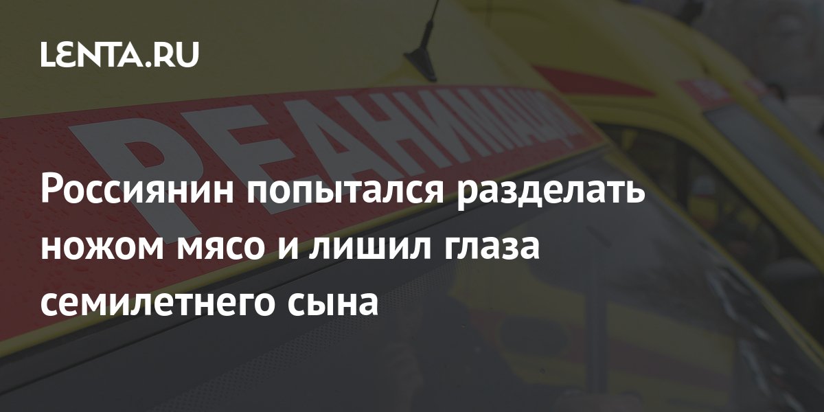 Как сохранить зрение ребенку, советует детский офтальмолог клиники «Прозрение» А.В. Картавин