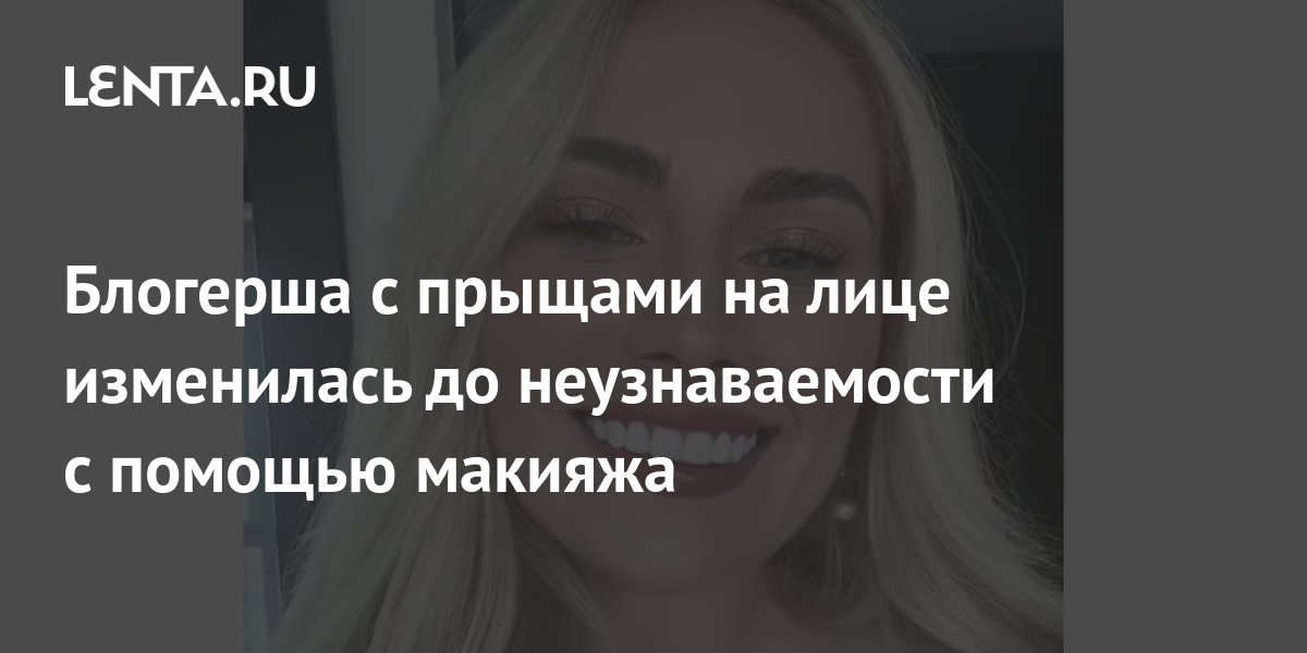 Блогерша с прыщами на лице изменилась до неузнаваемости с помощью ...
