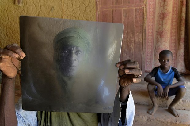 Бурильщик на урановом руднике Арева Салифу Адианфо консультируется с врачом по поводу проблем с легкими, Арлита, Нигер, 14 сентября 2014 года. Фото: Patrick Chapius / Gamma-Rapho / Getty Images