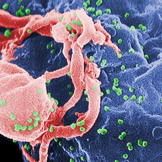 Объяснен механизм контроля вируса без лекарств у некоторых зараженных ВИЧ