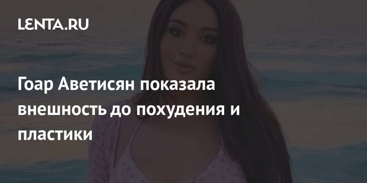Гоар Аветисян показала внешность до похудения и пластики: Внешний вид ...