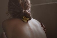 Симптомы и лечение псориаза. Что такое псориаз и кто к нему предрасположен?