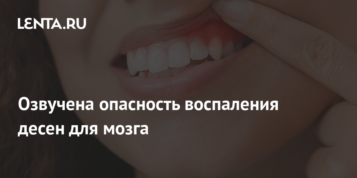 Озвучена опасность воспаления десен для мозга: Здоровье: Наука и ...