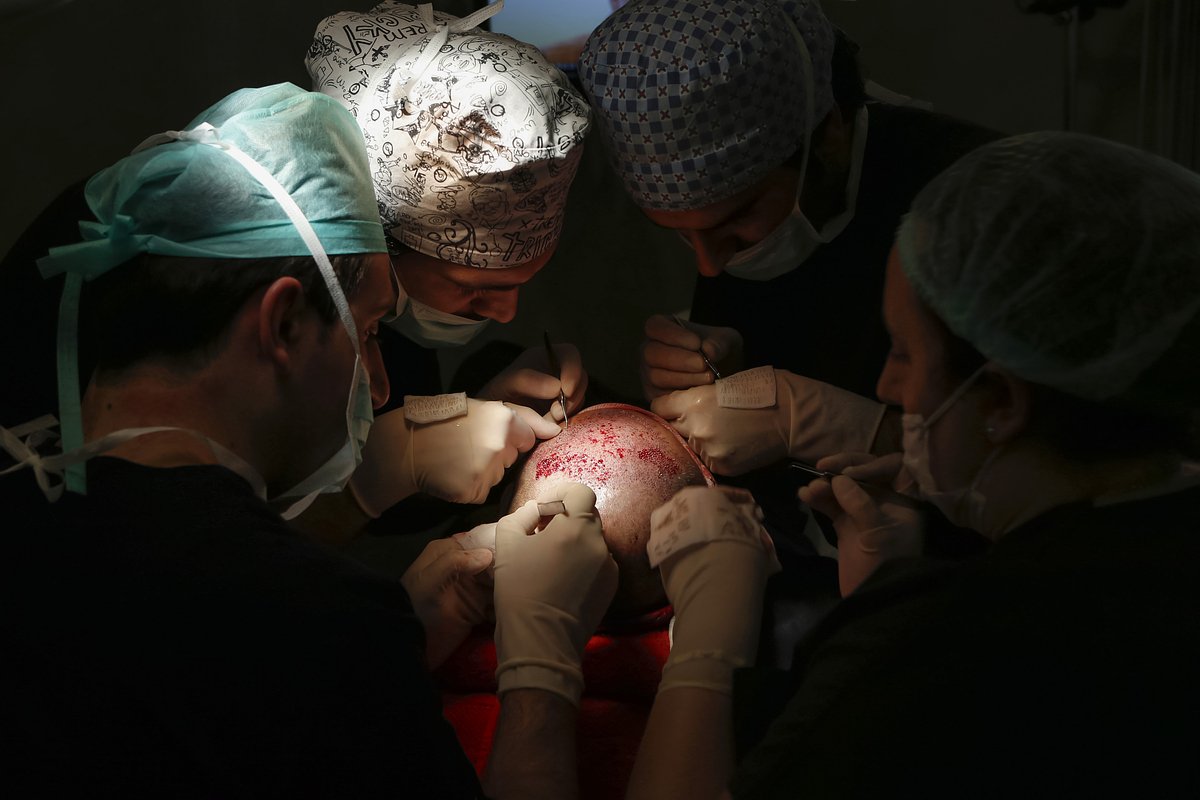 Путешественники из разных стран мира приезжают в Турцию на операции по трансплантации волос