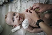 «Тёма очень хочет жить» Четырехмесячного малыша спасет внутривенное питание. Ему нужна ваша помощь