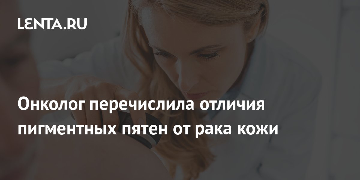 Онколог перечислила отличия пигментных пятен от рака кожи: Уход за ...