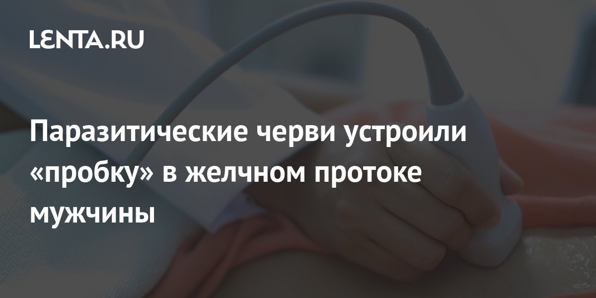 Паразитические черви устроили «пробку» в желчном протоке мужчины: Люди ...