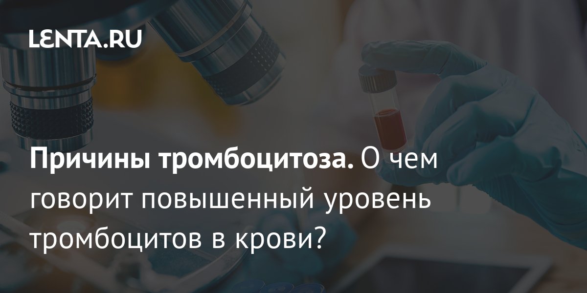 Эссенциальный Тромбоцитоз