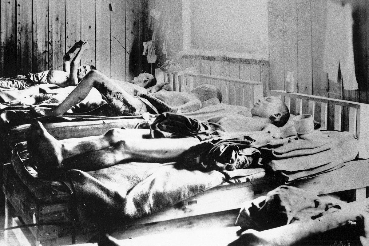 Выжившие после взрыва атомной бомбы в Хиросиме в 1945 году