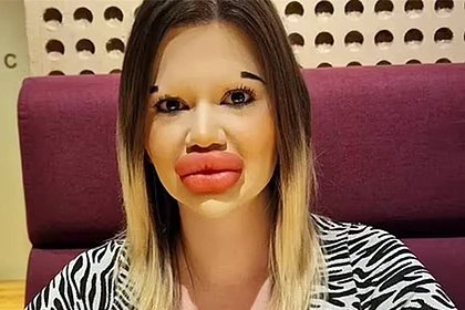 Женщина с самыми большими губами в мире решила найти мужчину. Назвала главное требование — Фото