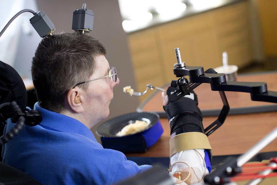 Билл Кочевар с имплантированной системой, которая позволяет ему двигать конечностями, парализованными в течение восьми лет
