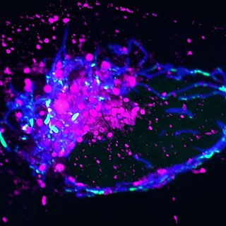 Обнаружена причина хронического воспаления при старении