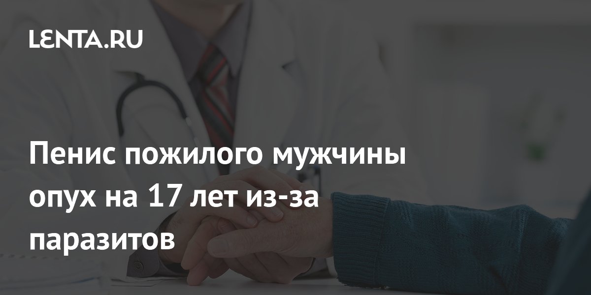 Сильный, эффективный, высококлассный кольцо на член пожилого человека - balkharceramics.ru