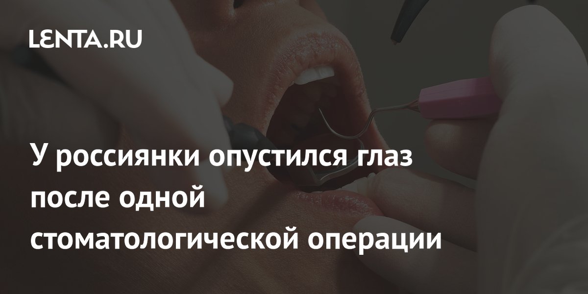 У россиянки опустился глаз после одной стоматологической операции ...