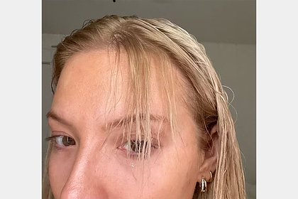 Блогерша обесцветила волосы в домашних условиях и облысела
