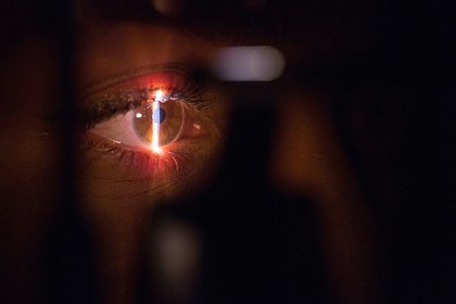 Россиянам назвали опасные последствия синдрома сухого глаза