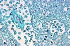 Амеба Naegleria fowleri
