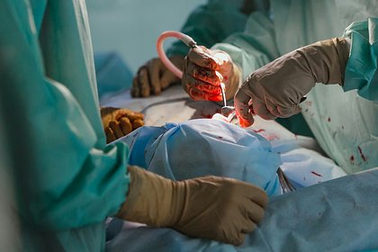 Медики стали «оживлять» людей для трансплантации органов