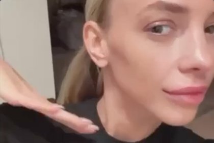 40-летняя звезда Comedy Woman показала внешность после удаления филлеров из губ