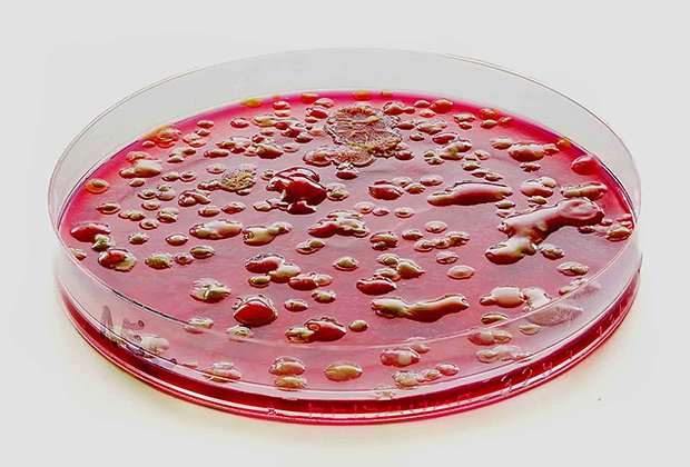 Petri dish with colonies of pathogenic fungi