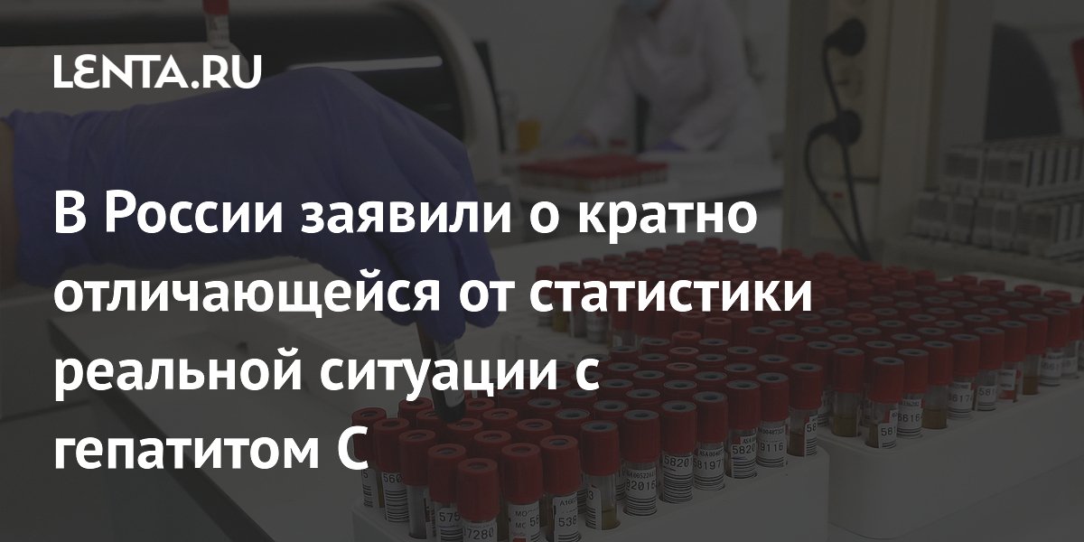 В России заявили о кратно отличающейся от статистики реальной ситуации с гепатитом C