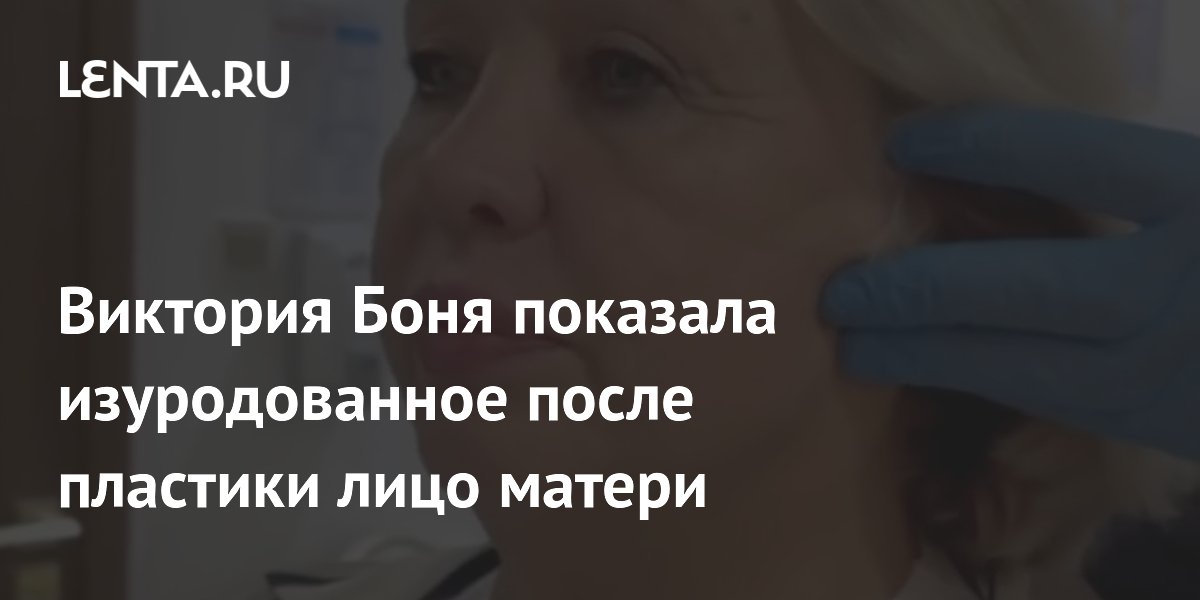 Виктория Боня показала изуродованное после пластики лицо матери