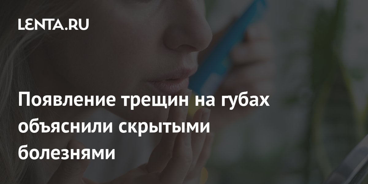 Появление трещин на губах объяснили скрытыми болезнями