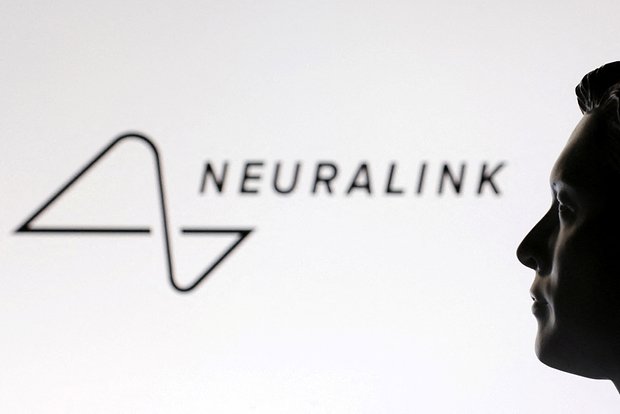 Neuralink Илона Маска заявил о планах вернуть зрение слепым с помощью чипа Blindsight