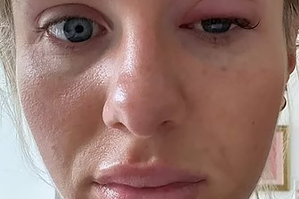 Звезда реалити-шоу показала изменение во внешности и напугала пользователей сети