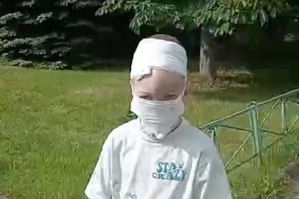 Мальчика из Сочи с разорванным собаками лицом сняли на видео после пластики