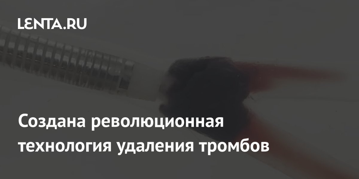 Революция в лечении инсульта: Новый миниатюрный прибор эффективно удаляет тромбы