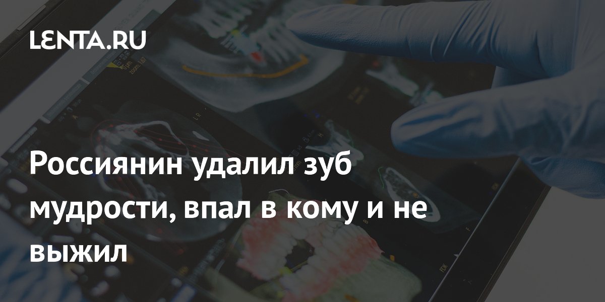 Россиянин удалил зуб мудрости, впал в кому и не выжил
