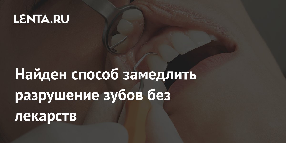 Найден способ замедлить разрушение зубов без лекарств
