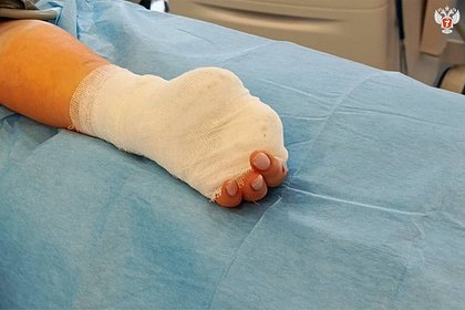 Россиянка приняла ванну и осталась без пальцев