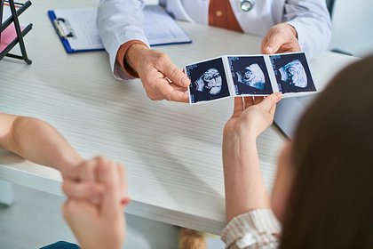 В российском регионе число абортов сократилось до нуля