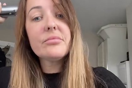 Женщина устала от насмешек и потратила полмиллиона рублей на уменьшение лба