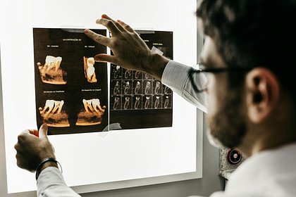 Врач предупредила россиян с одним распространенным заболеванием о риске потерять зубы