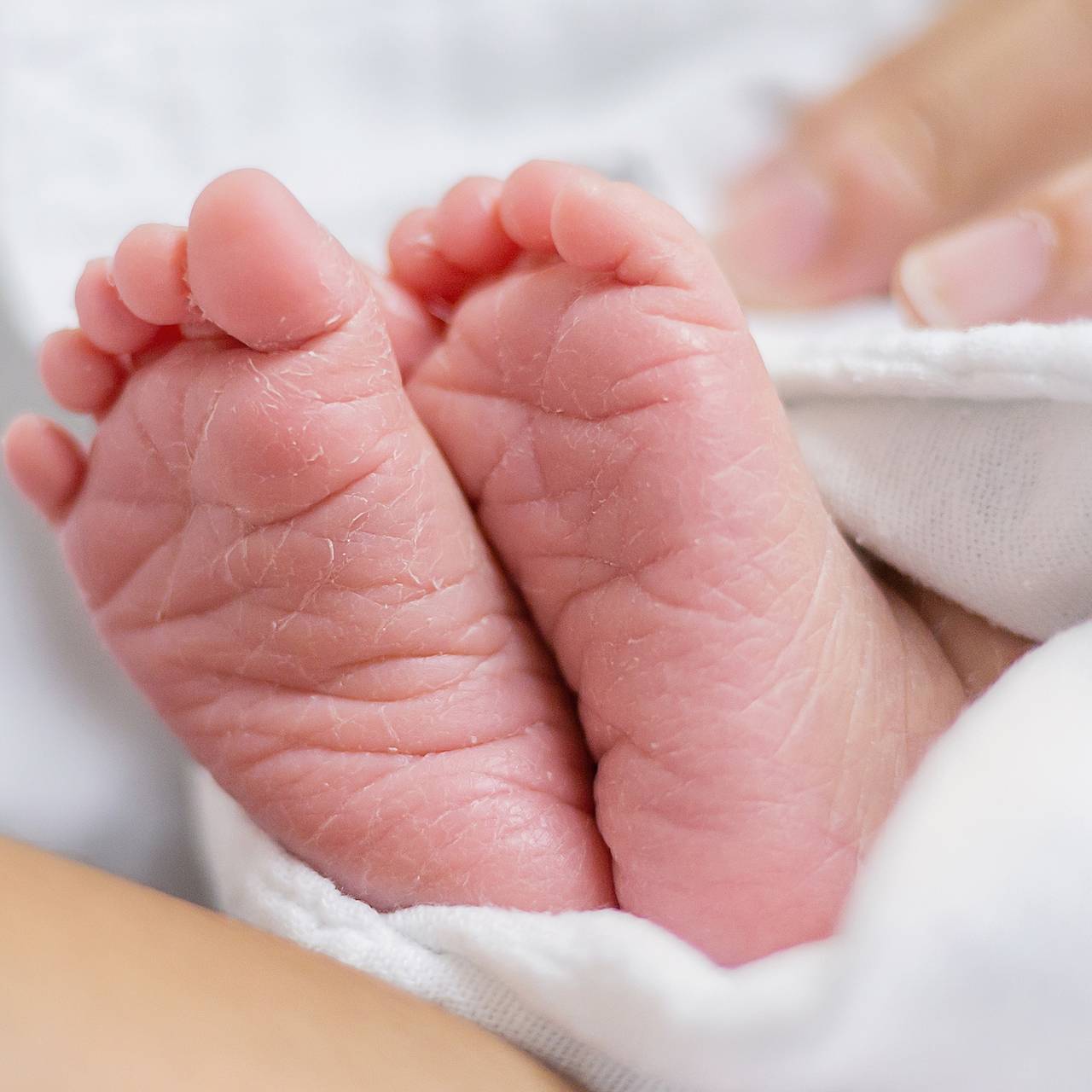 В животе 11-дневного младенца обнаружили близнеца-паразита