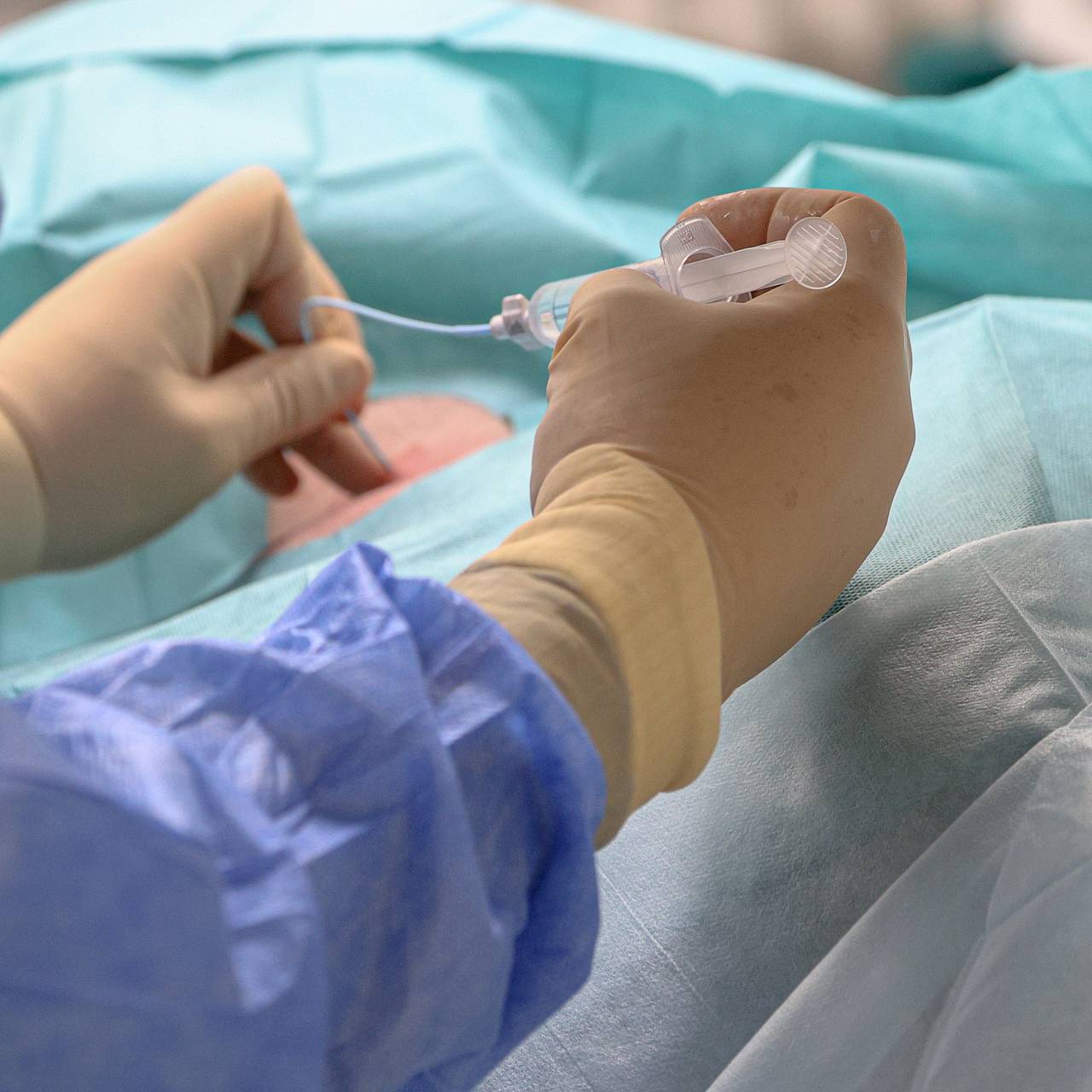 Прототип устройства для лечения рака микроволновым излучением разработали в России